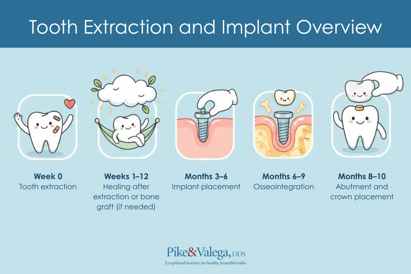 tooth-extraction-to-implant-timeline-illustration Illustration showing timeline from tooth extraction to implant and crown placement