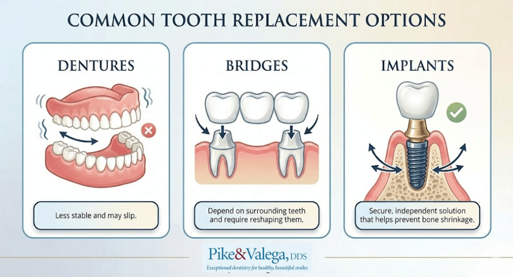 tooth-replacement-options-infographic Common tooth replacement options.